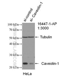 Caveolin-1 Rabbit anti-Human, Mouse, Rat, Polyclonal, Proteintech:Antibodies:Primary