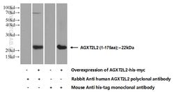 AGXT2L2 Rabbit anti-Human, Mouse, Rat, Polyclonal, Proteintech 20 &mu;L | Buy Online | Proteintech | Fisher Scientific