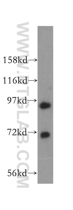 MCM8 Rabbit anti-Human, Mouse, Rat, Polyclonal, Proteintech:Antibodies:Primary
