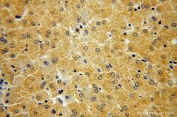 HGD Rabbit anti-Human, Mouse, Rat, Polyclonal, Proteintech 150 &mu;L; Unconjugated:Antibodies,