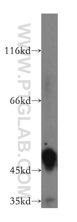 HGD Rabbit anti-Human, Mouse, Rat, Polyclonal, Proteintech 150 &mu;L; Unconjugated:Antibodies,