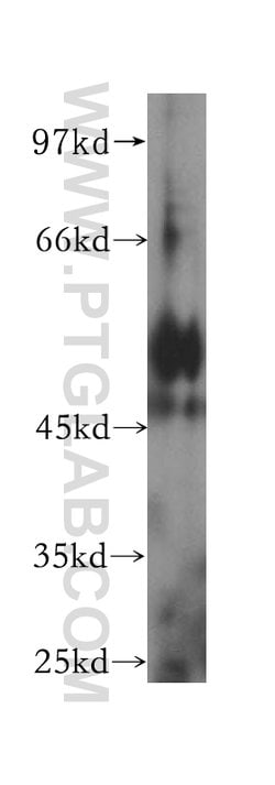 HGD Rabbit anti-Human, Mouse, Rat, Polyclonal, Proteintech 150 &mu;L; Unconjugated:Antibodies,