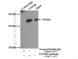 GTF2B Rabbit anti-Human, Mouse, Rat, Polyclonal, Proteintech