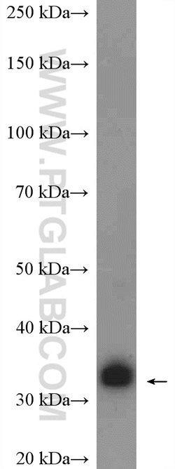 GTF2B Rabbit anti-Human, Mouse, Rat, Polyclonal, Proteintech:Anticorps:Anticorps