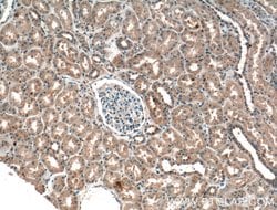 ADH4 Rabbit anti-Human, Mouse, Rat, Polyclonal, Proteintech:Antibodies:Primary