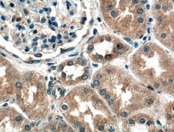 ADH4 Rabbit anti-Human, Mouse, Rat, Polyclonal, Proteintech:Antibodies:Primary