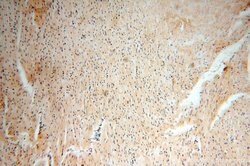 ADH4 Rabbit anti-Human, Mouse, Rat, Polyclonal, Proteintech:Antibodies:Primary