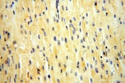 ADH4 Rabbit anti-Human, Mouse, Rat, Polyclonal, Proteintech:Antibodies:Primary