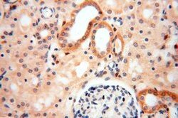 ADH4 Rabbit anti-Human, Mouse, Rat, Polyclonal, Proteintech:Antibodies:Primary