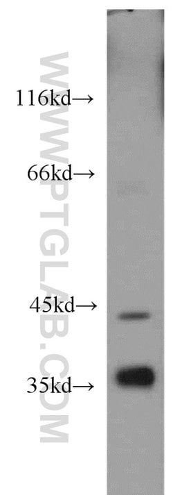 ADH4 Rabbit anti-Human, Mouse, Rat, Polyclonal, Proteintech:Antibodies:Primary