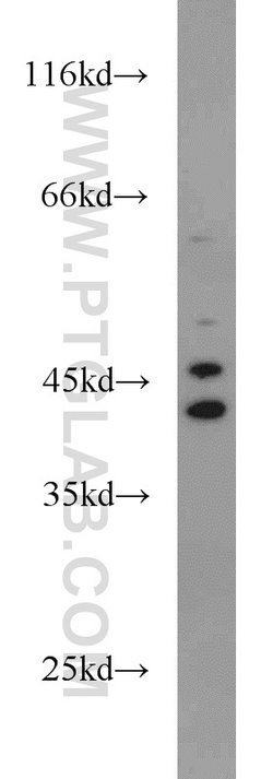 ADH4 Rabbit anti-Human, Mouse, Rat, Polyclonal, Proteintech:Antibodies:Primary