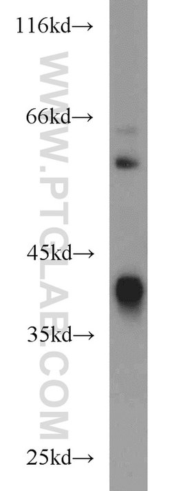ADH4 Rabbit anti-Human, Mouse, Rat, Polyclonal, Proteintech:Antibodies:Primary