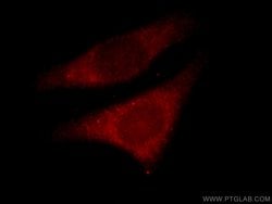 MVP/LRP Rabbit anti-Human, Mouse, Rat, Polyclonal, Proteintech 150 &mu;L;