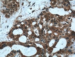 MVP/LRP Rabbit anti-Human, Mouse, Rat, Polyclonal, Proteintech 150 &mu;L;