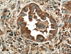 MVP/LRP Rabbit anti-Human, Mouse, Rat, Polyclonal, Proteintech 150 &mu;L;