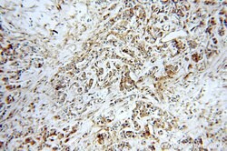 MVP/LRP Rabbit anti-Human, Mouse, Rat, Polyclonal, Proteintech 150 &mu;L;