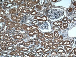 MVP/LRP Rabbit anti-Human, Mouse, Rat, Polyclonal, Proteintech 150 &mu;L;