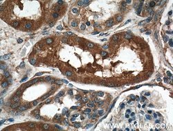 MVP/LRP Rabbit anti-Human, Mouse, Rat, Polyclonal, Proteintech 150 &mu;L;
