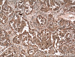 MVP/LRP Rabbit anti-Human, Mouse, Rat, Polyclonal, Proteintech 150 &mu;L;