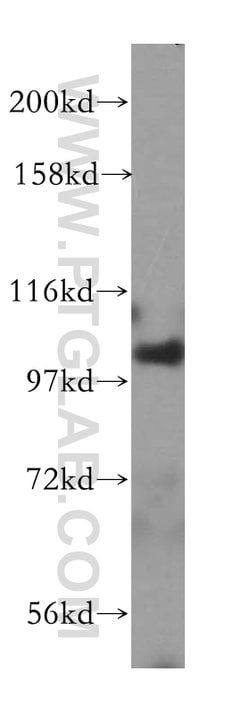 MVP/LRP Rabbit anti-Human, Mouse, Rat, Polyclonal, Proteintech 150 &mu;L;