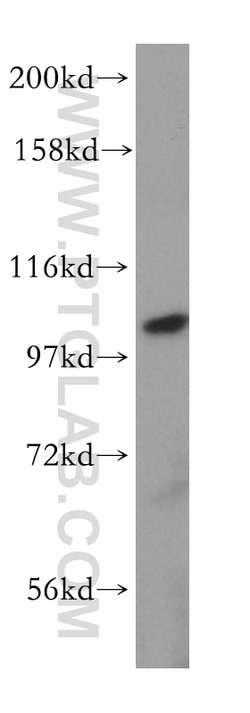 MVP/LRP Rabbit anti-Human, Mouse, Rat, Polyclonal, Proteintech 150 &mu;L;