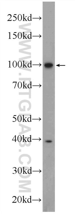 MVP/LRP Rabbit anti-Human, Mouse, Rat, Polyclonal, Proteintech 150 &mu;L;