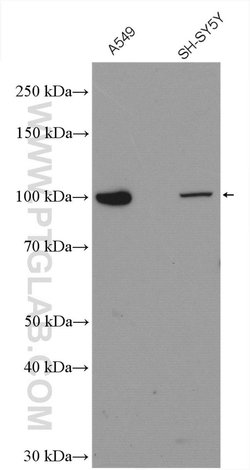 MVP/LRP Rabbit anti-Human, Mouse, Rat, Polyclonal, Proteintech 150 &mu;L;