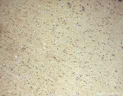 Proteintech ADO Rabbit anti-Human, Mouse, Rat, Polyclonal, Proteintech