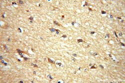 ADO Rabbit anti-Human, Mouse, Rat, Polyclonal, Proteintech:Anticorps:Anticorps