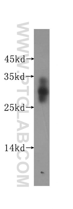 ADO Rabbit anti-Human, Mouse, Rat, Polyclonal, Proteintech:Anticorps:Anticorps