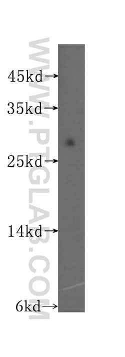 ADO Rabbit anti-Human, Mouse, Rat, Polyclonal, Proteintech:Anticorps:Anticorps