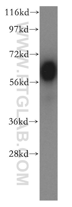 BTN2A2 Rabbit anti-Human, Mouse, Rat, Polyclonal, Proteintech 150 &mu;L;