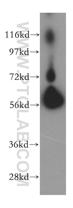 BTN2A2 Rabbit anti-Human, Mouse, Rat, Polyclonal, Proteintech 150 &mu;L;