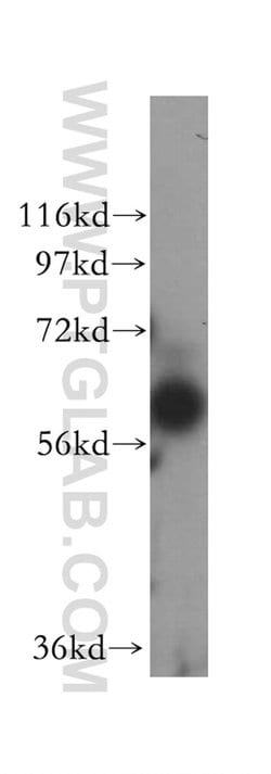 BTN2A2 Rabbit anti-Human, Mouse, Rat, Polyclonal, Proteintech 150 &mu;L;