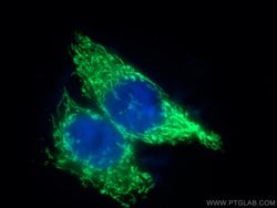 ATP5I Rabbit anti-Human, Mouse, Rat, Polyclonal, Proteintech:Antibodies:Primary