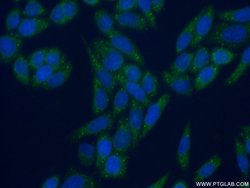 EDC3 Rabbit anti-Human, Mouse, Rat, Polyclonal, Proteintech:Anticorps:Anticorps