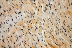 EDC3 Rabbit anti-Human, Mouse, Rat, Polyclonal, Proteintech:Anticorps:Anticorps
