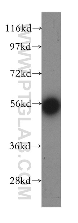 EDC3 Rabbit anti-Human, Mouse, Rat, Polyclonal, Proteintech:Anticorps:Anticorps