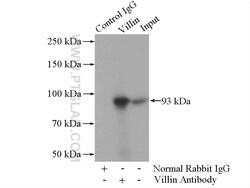 Villin Rabbit anti-Human, Mouse, Rat, Polyclonal, Proteintech 150 &mu;L;
