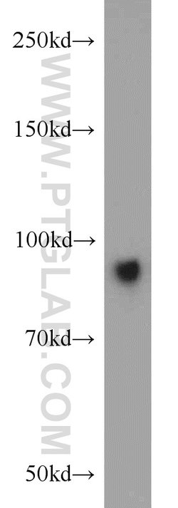 Villin Rabbit anti-Human, Mouse, Rat, Polyclonal, Proteintech 150 &mu;L;