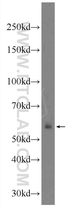 IGHD Rabbit anti-Human, Polyclonal, Proteintech 150 &mu;L; Unconjugated:Antibodies,