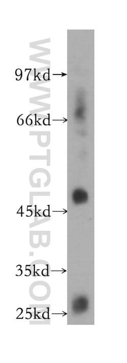 Proteintech GPR137B Rabbit anti-Human, Polyclonal, Proteintech