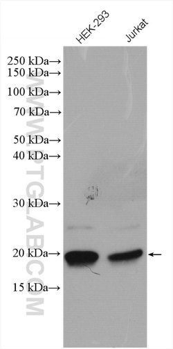BTF3L4 Rabbit anti-Human, Mouse, Rat, Polyclonal, Proteintech 150 &mu;L;