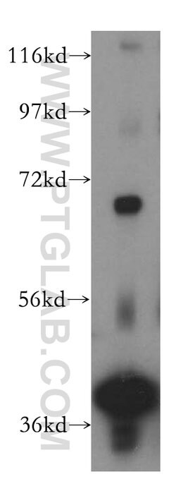 DNAJB14 Rabbit anti-Human, Mouse, Rat, Polyclonal, Proteintech 20 &mu;L;
