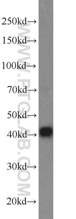 DNAJB14 Rabbit anti-Human, Mouse, Rat, Polyclonal, Proteintech 20 &mu;L;