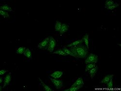 SDCCAG10 Rabbit anti-Human, Mouse, Rat, Polyclonal, Proteintech 150 &mu;L;