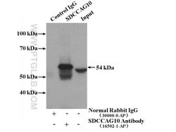 SDCCAG10 Rabbit anti-Human, Mouse, Rat, Polyclonal, Proteintech 150 &mu;L;