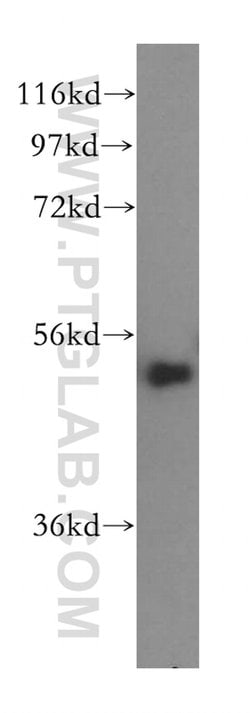 SDCCAG10 Rabbit anti-Human, Mouse, Rat, Polyclonal, Proteintech 150 &mu;L;