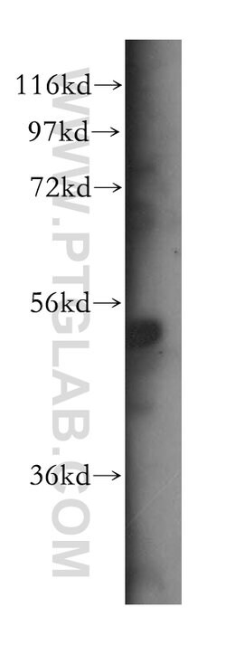 SDCCAG10 Rabbit anti-Human, Mouse, Rat, Polyclonal, Proteintech 150 &mu;L;