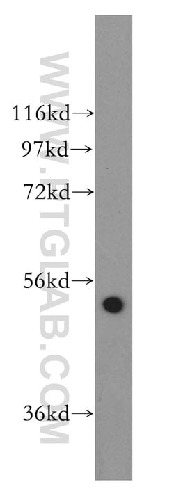 SDCCAG10 Rabbit anti-Human, Mouse, Rat, Polyclonal, Proteintech 150 &mu;L;